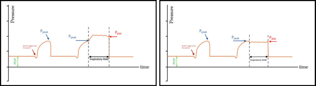 Figure 1a-1b