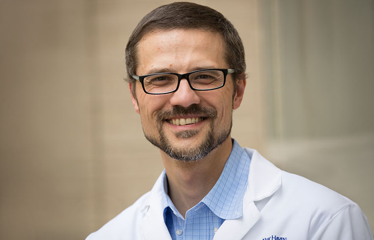 Hypoxic burden from sleep apnea may predict peri-operative outcomes better than AHI